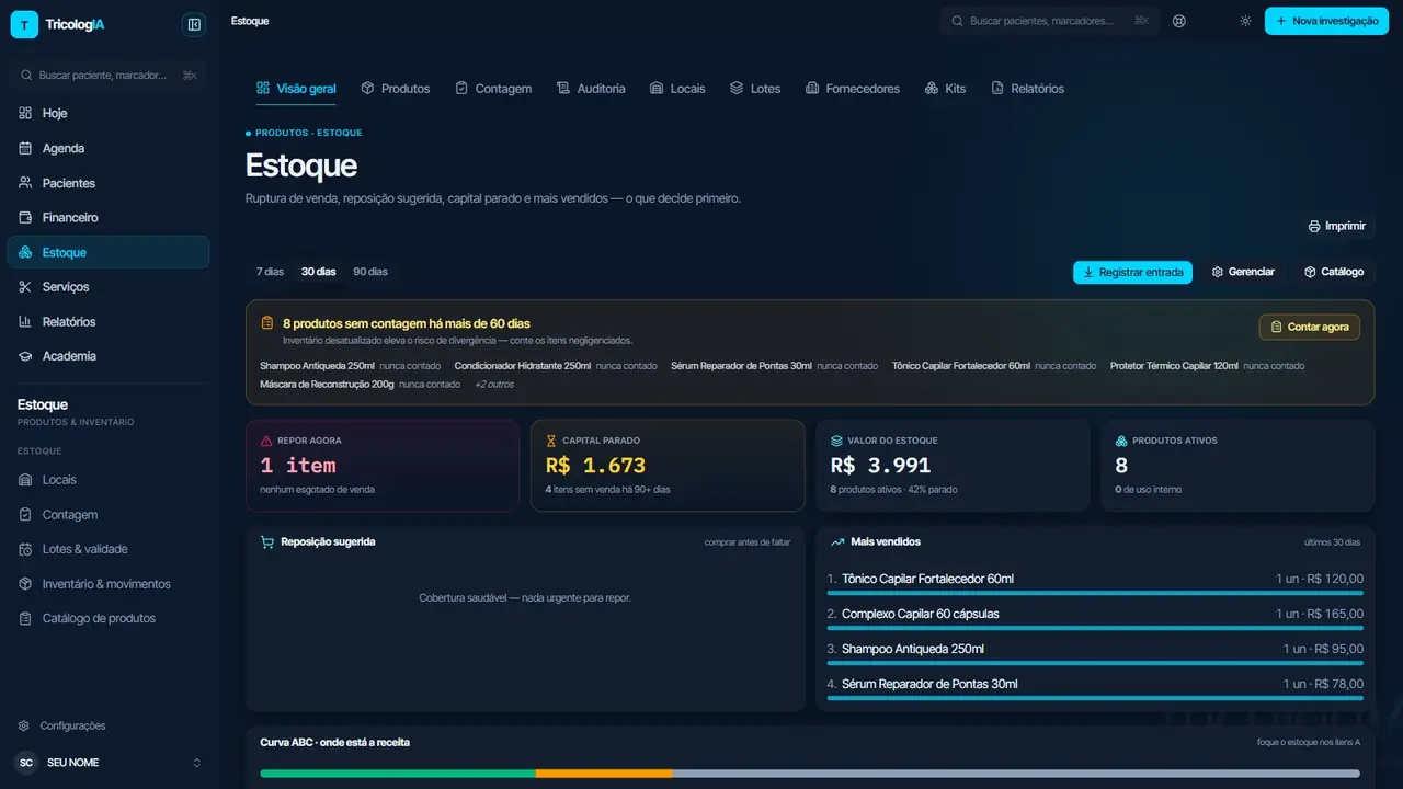 Painel de estoque com produtos abaixo do mínimo sinalizados para reposição